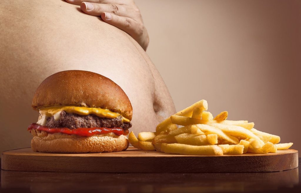 Obesity and Physiotherapy Featured Image